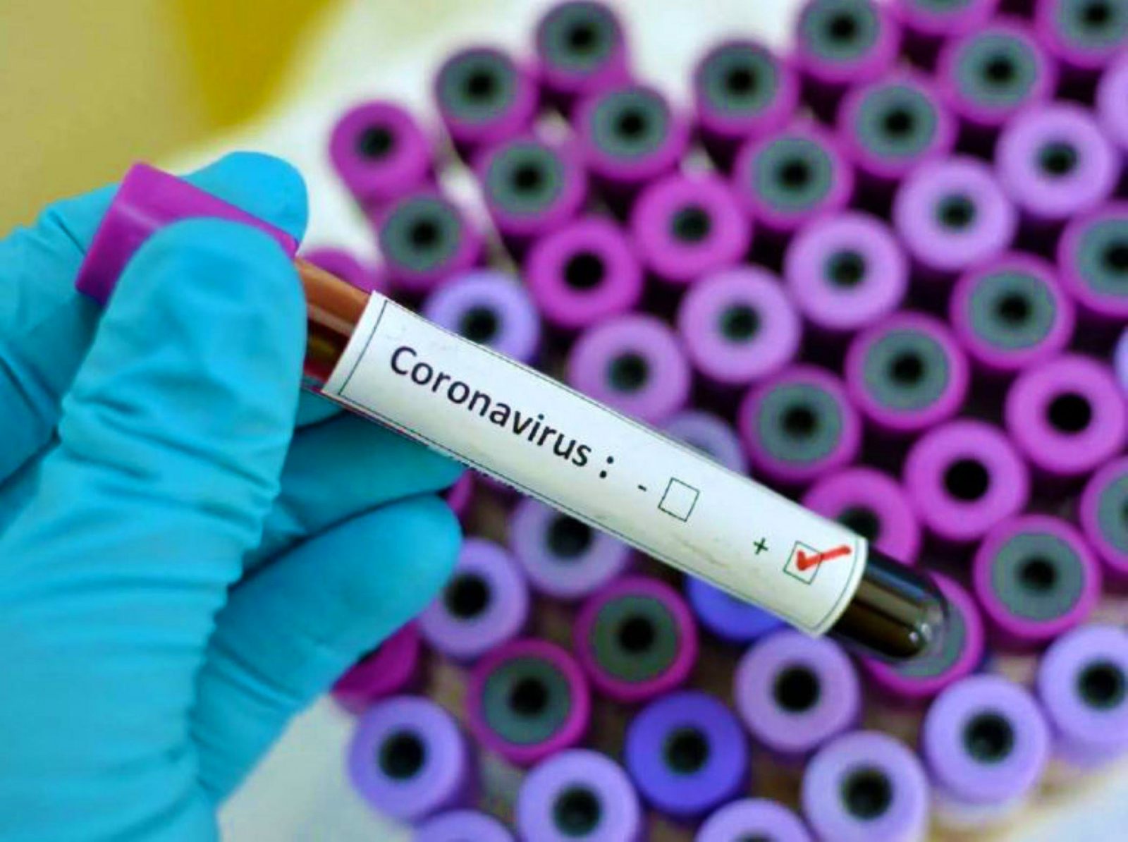COVID-19 virus can get onto a phone or tablet in two ways: either in tiny droplets